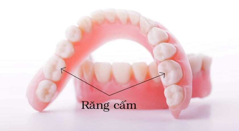 Răng cấm thuộc nhóm răng cối, là răng số 6 và số 7 của cung răng