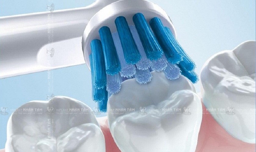 Tích cực vệ sinh răng miệng để giảm thiểu viêm lợi có mủ
