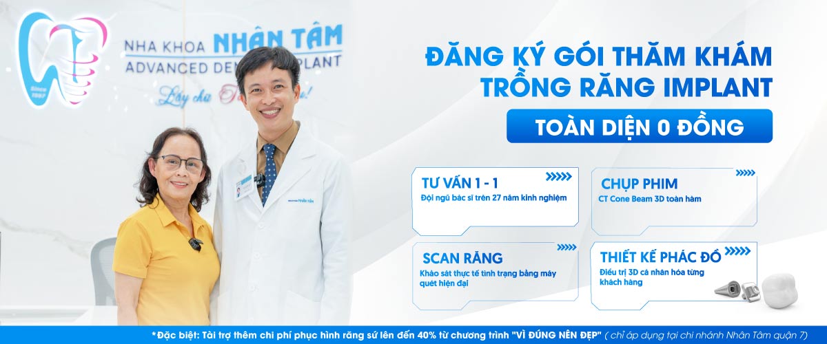 Đăng ký gói thăm khám Implant Hình: Đăng ký gói thăm khám Implant