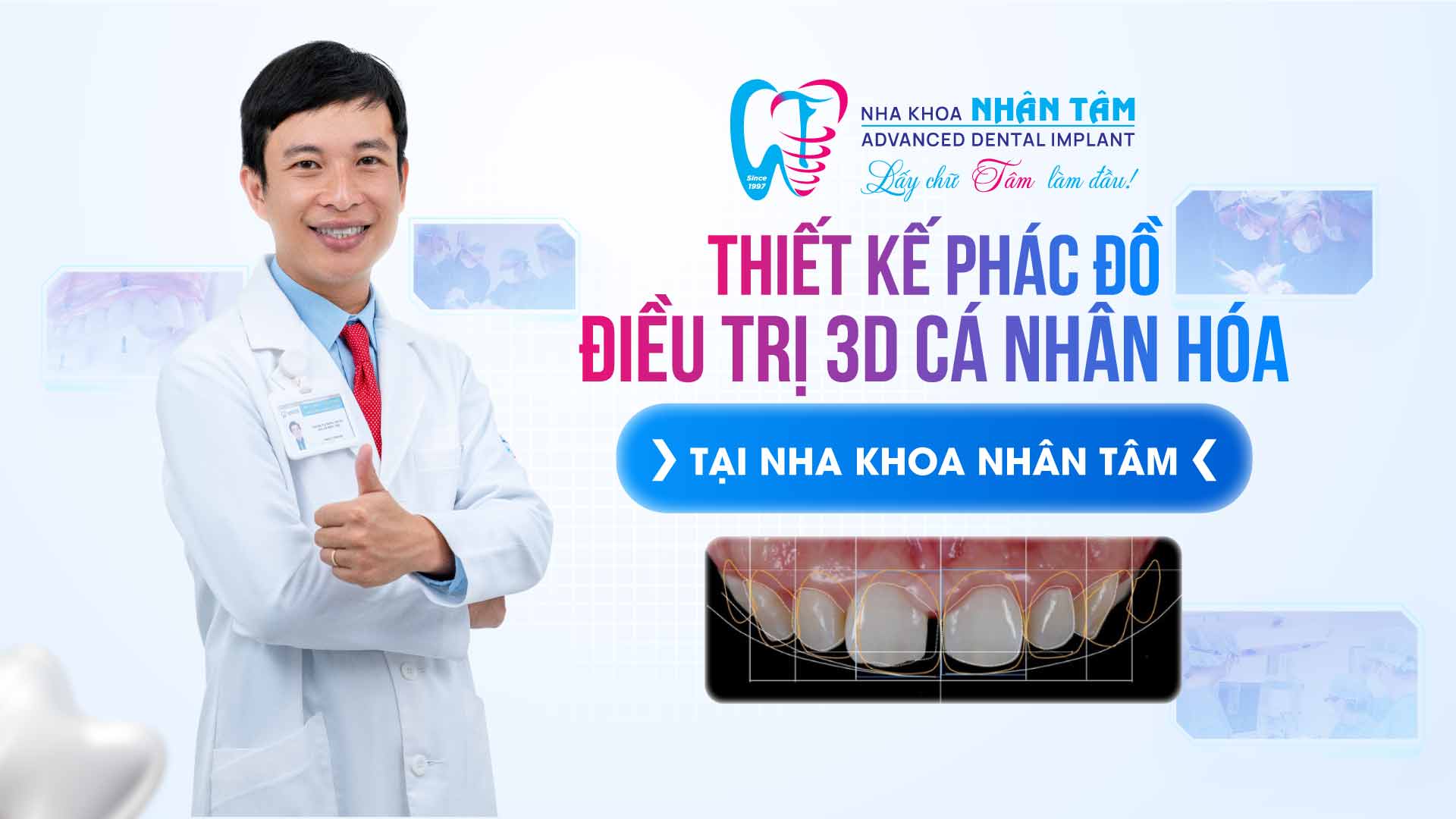 Hình: Thiết kế phác đồ điều trị 3D cá nhân hóa từng khách hàng