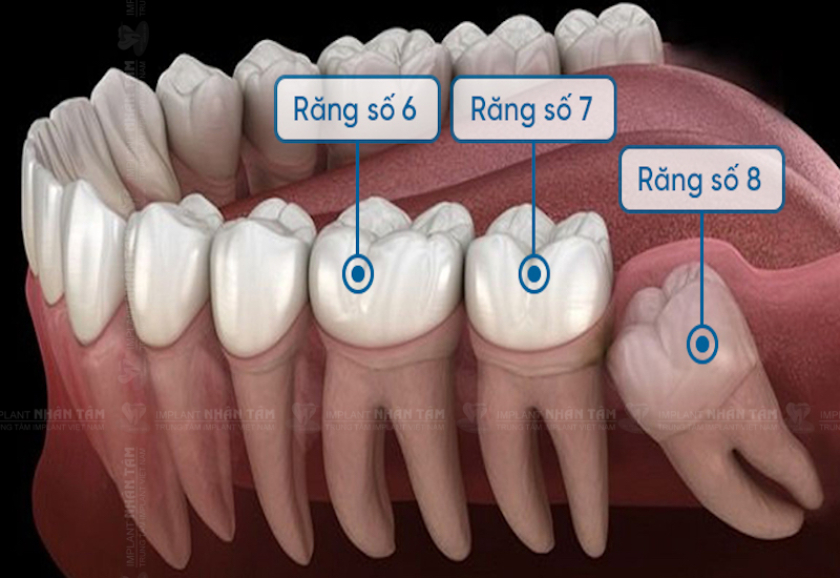 Đặc điểm răng số 7 là kích thước lớn, chân răng to, vô cùng chắc khỏe