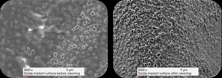 Bề mặt Implant trước và sau khi được khử nhiễm bởi công nghệ làm sạch GalvoSurge