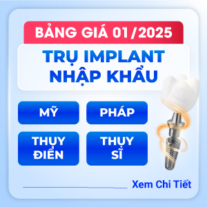 Bảng giá trồng răng Implant 