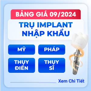 Bảng giá trồng răng Implant 