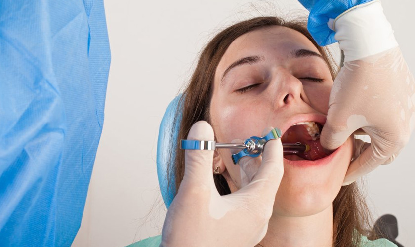 Trồng răng Implant không đau nhức như nhiều người vẫn nghĩ