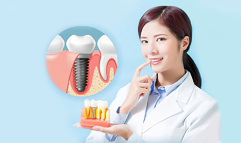 Trồng răng Implant giá bao nhiêu tại TPHCM?
