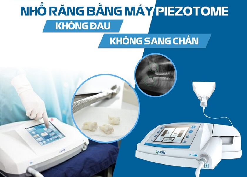Công nghệ nhổ răng khôn không đau với máy siêu âm Piezotome