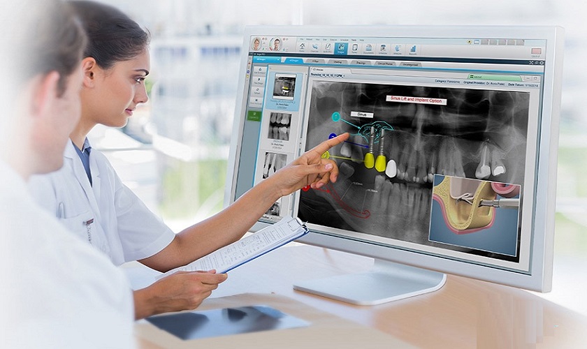 Trồng răng Implant cần được hỗ trợ bởi nhiều trang thiết bị hiện đại