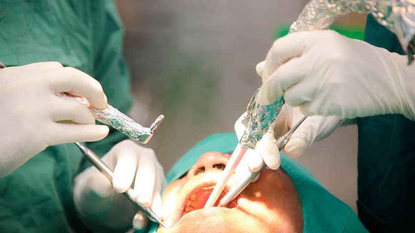 Gây tê hay gây mê trong phẫu thuật trồng răng Implant?