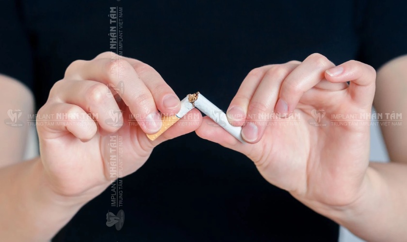 Cần ngưng hút thuốc lá trước và sau khi trồng răng Implant
