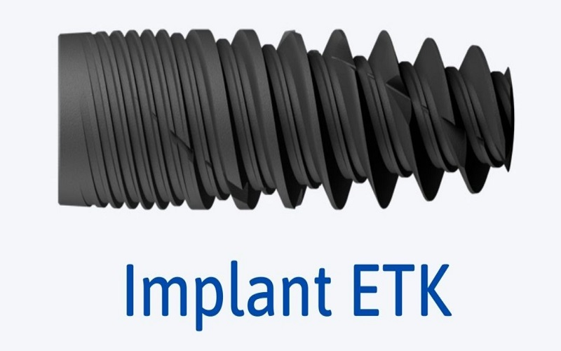 Implant ETK - Xuất xứ, ưu điểm và giá cả