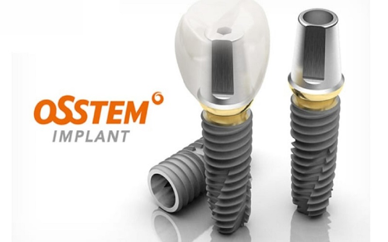 Trụ Implant Osstem - Xuất xứ, ưu điểm và giá cả
