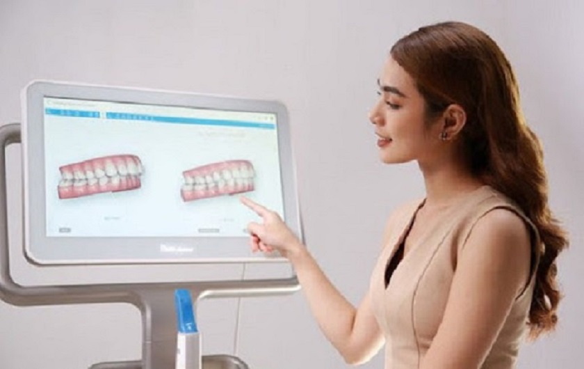 Khách hàng được trực tiếp tham gia vào quá trình điều chỉnh kết quả với máy lấy dấu răng kỹ thuật số hiện đại