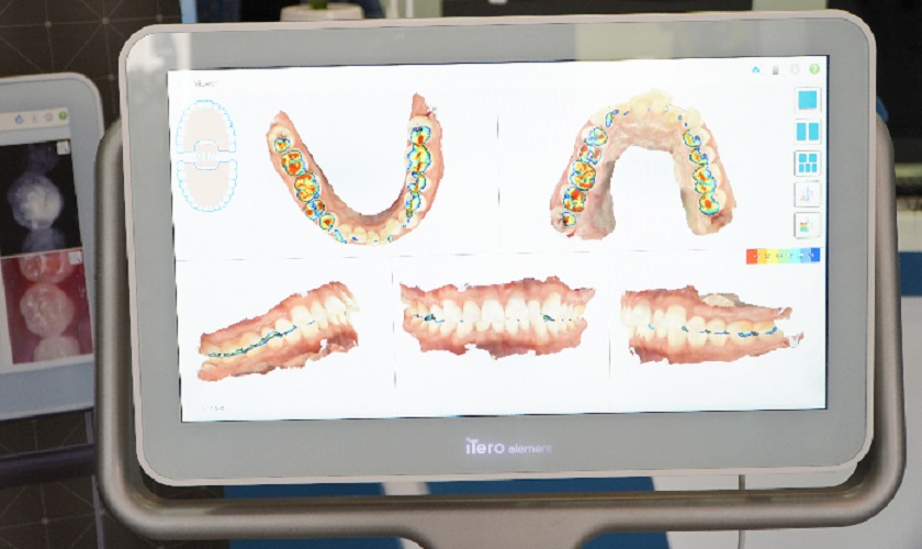 Công nghệ trước cũ chỉ cho phép thấy được hình ảnh của răng và xương chứ không phải toàn bộ gương mặt
