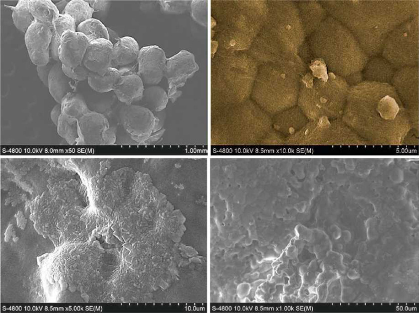 Innovative Scaffold Solution for Bone Regeneration Made of Beta-Tricalcium Phosphate Granules, Autologous Fibrin Fold, and Peripheral Blood Stem Cells