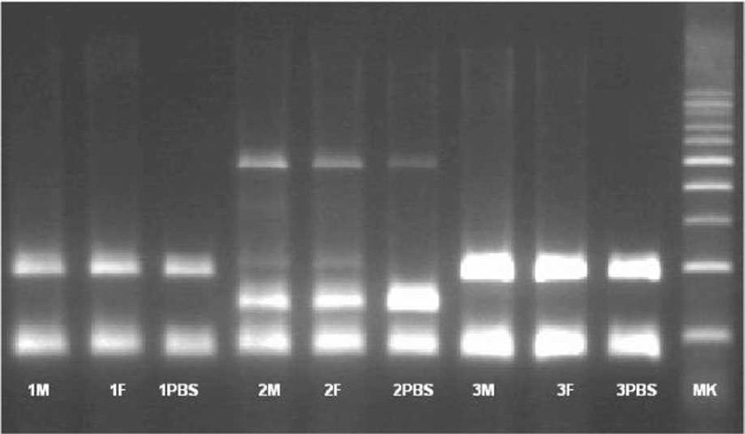 Innovative Scaffold Solution for Bone Regeneration Made of Beta-Tricalcium Phosphate Granules, Autologous Fibrin Fold, and Peripheral Blood Stem Cells