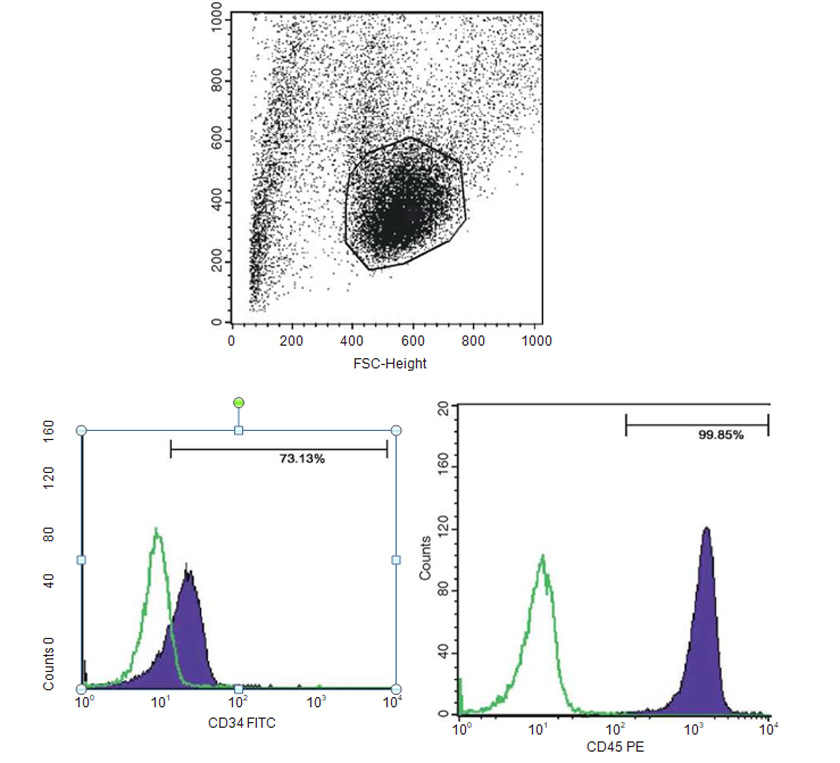 Innovative Scaffold Solution for Bone Regeneration Made of Beta-Tricalcium Phosphate Granules, Autologous Fibrin Fold, and Peripheral Blood Stem Cells