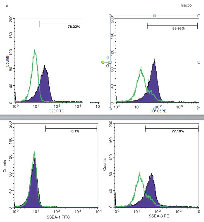 Innovative Scaffold Solution for Bone Regeneration Made of Beta-Tricalcium Phosphate Granules, Autologous Fibrin Fold, and Peripheral Blood Stem Cells