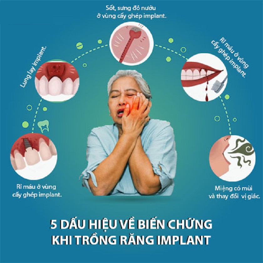 Các dấu hiệu bệnh nhân đang bị biến chứng khi trồng răng Implant