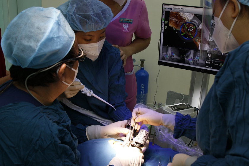 Các bác sĩ tại Trung tâm Implant Việt Nam tiến hành đặt trụ Implant với sự trợ giúp của công nghệ định vị