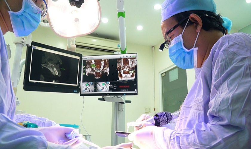 Quy trình cấy ghép Implant được thực hiện với độ chính xác cao, giúp giảm thiểu biến chứng