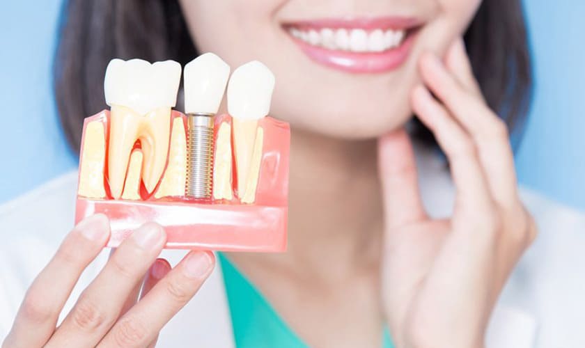 Trồng răng implant được đánh giá cao về hiệu quả phục hồi răng đã mất