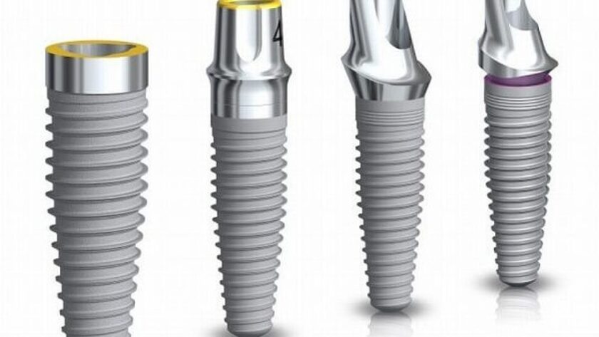 Trên thị trường hiện nay có khá nhiều loại trụ implant khác nhau