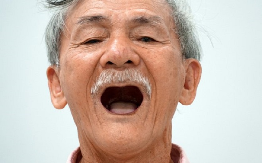 Tuổi tác cao là một trong những nguyên nhân gây mất răng hàm