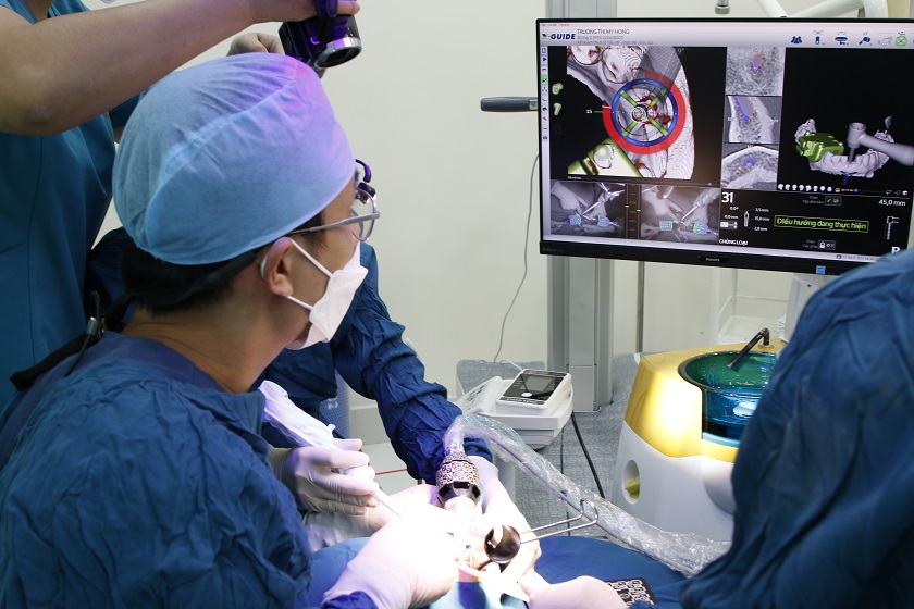 Bác sĩ CKI Trương Chí Bảo trong ca cấy ghép implant cho khách hàng với công nghệ định vị