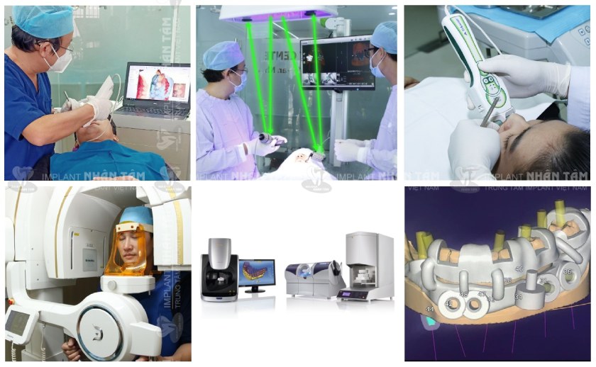 Trung tâm Implant Việt Nam sở hữu công nghệ nha khoa hiện đai