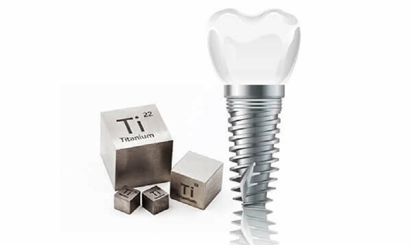 Trụ Implant được làm từ chất liệu quý Titanium