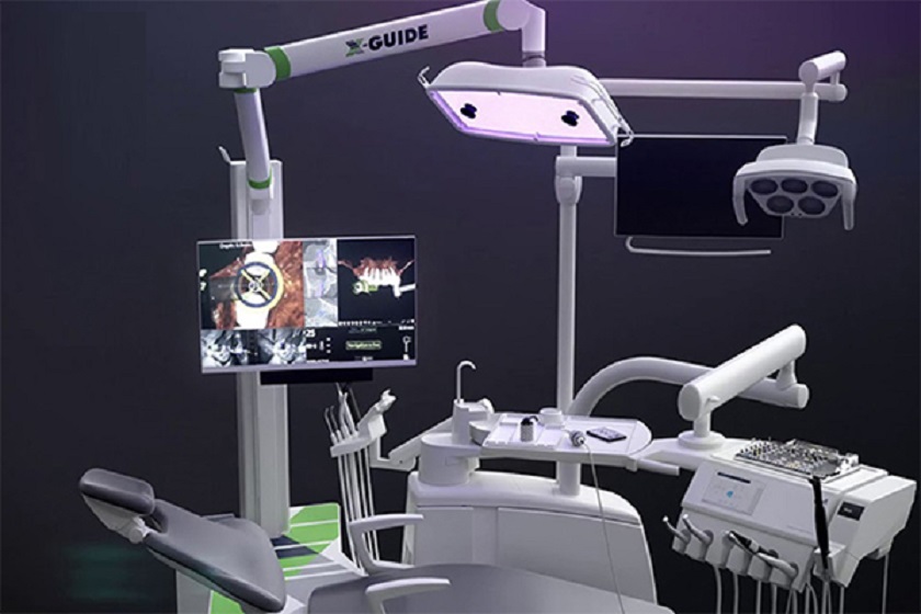 X - Guide – công nghệ định vị cấy ghép Implant hiện đại