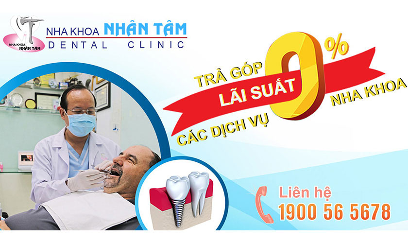 Trồng răng Implant trả góp tại Trung tâm Implant Việt Nam