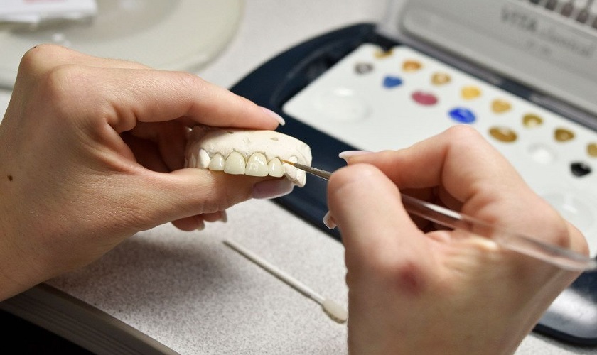Hệ thống labo làm răng sứ, răng giả tháo lắp riêng tại Nha khoa Nhân Tâm