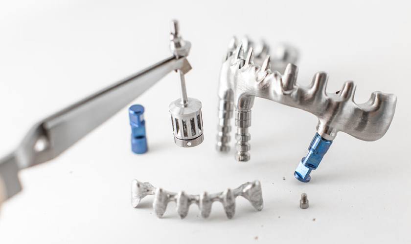Vào năm 1939, Bác sĩ Dahl đặt ý tưởng cho kỹ thuật Implant dưới màng xương và được ứng dụng lần đầu tiên vào năm 1940 nhưng không thành công Vào năm 1939, Bác sĩ Dahl đặt ý tưởng cho kỹ thuật Implant dưới màng xương và được ứng dụng lần đầu tiên vào năm 1940 nhưng không thành công