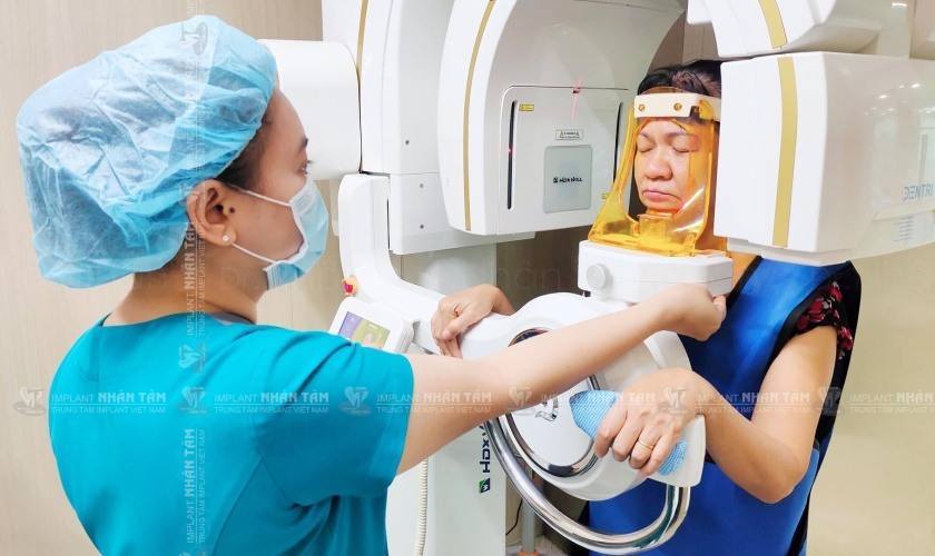 Nhờ vào các thiết bị chụp cắt lớp (CT Cone Beam) và máy scan kỹ thuật số, Bác sĩ có thể đánh giá chi tiết tình trạng xương hàm, xác định chính xác vị trí đặt Implant cũng như cấu trúc giải phẫu vùng miệng Nhờ vào các thiết bị chụp cắt lớp (CT Cone Beam) và máy scan kỹ thuật số, Bác sĩ có thể đánh giá chi tiết tình trạng xương hàm, xác định chính xác vị trí đặt Implant cũng như cấu trúc giải phẫu vùng miệng