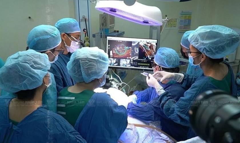 Implant cá nhân hóa cho phép cấy ghép trực tiếp mà không cần ghép xương Implant cá nhân hóa cho phép cấy ghép trực tiếp mà không cần ghép xương