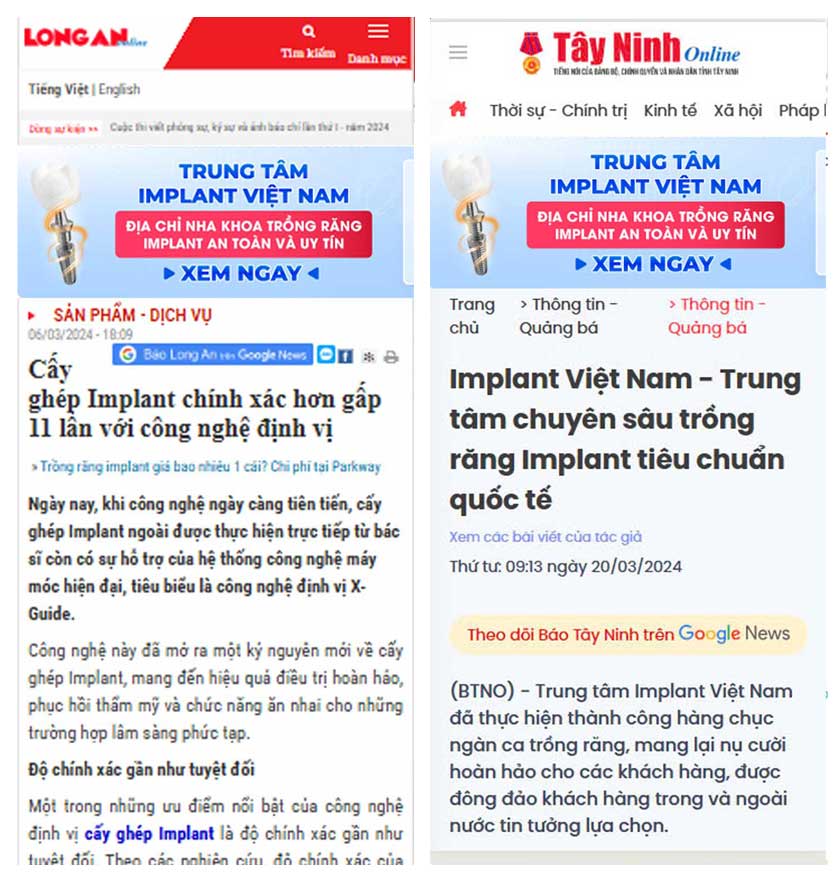 Báo Long An và Tây Ninh đưa tin trung tâm Implant Việt Nam