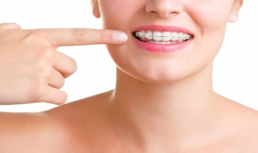 Trồng răng implant tpHCM ở đâu? Thời gian lành thương sau khi trồng răng implant