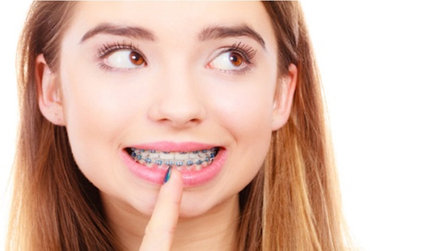 Trồng răng implant Tekka Pháp và Nobel Mỹ có điểm gì nổi bật?