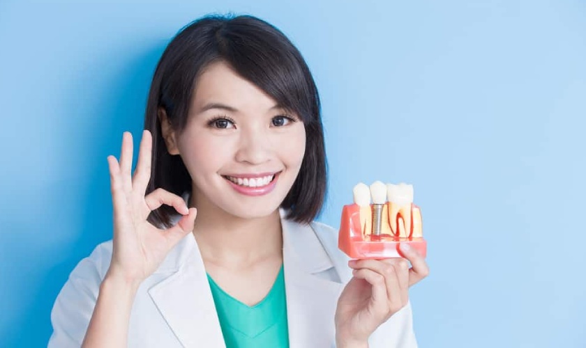 Bao lâu thì phải làm lại răng implant?