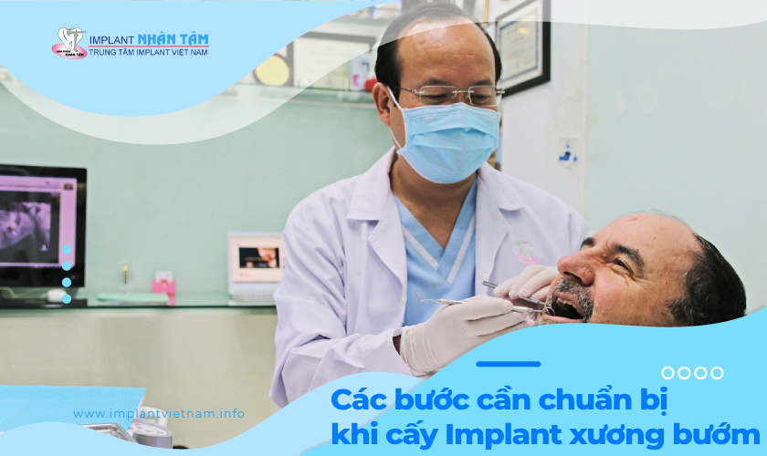 Các bước chuẩn bị trước khi cấy ghép Implant xương bướm