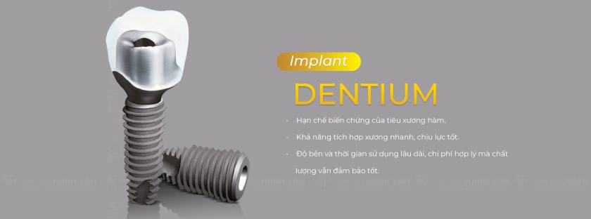 Implant Dentium với cấu tạo đặc biệt mang lại nhiều lợi ích vượt trội khi trồng răng Implant