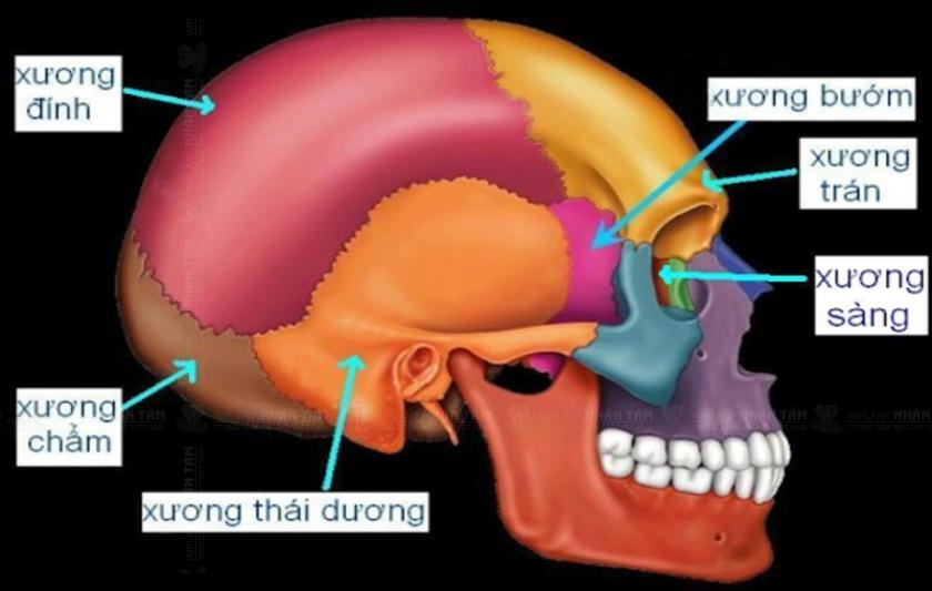 Vùng xương bướm cung cấp nền tảng ổn định vững chắc để nâng đỡ trụ Implant