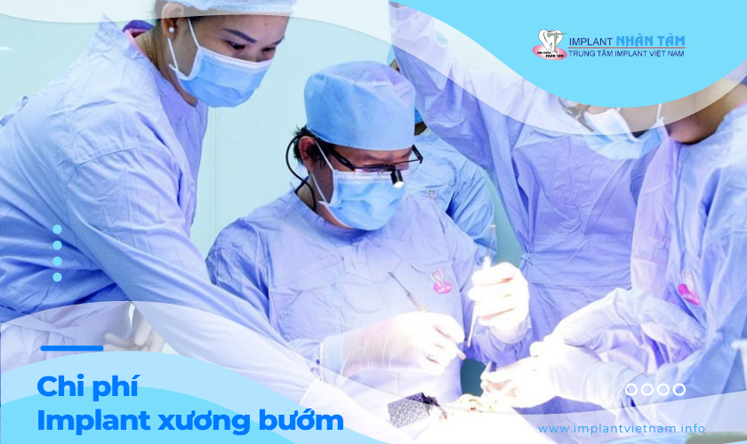 Chi phí cấy ghép Implant xương bướm