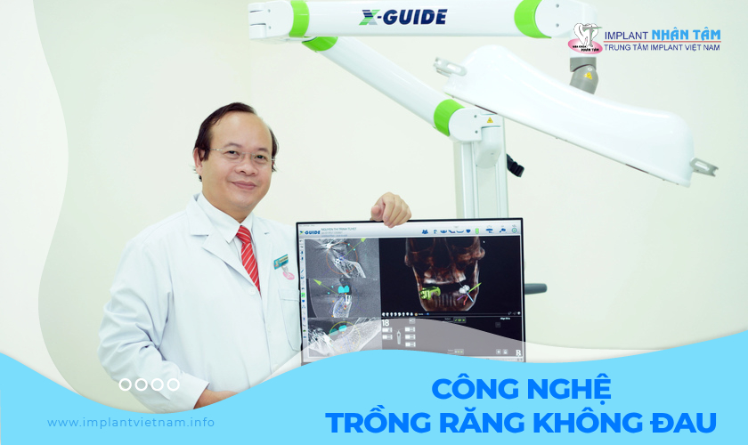 Công nghệ trồng răng Implant không đau, không biến chứng 