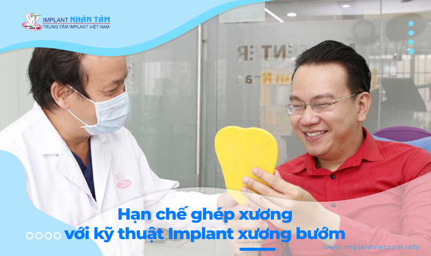 Hạn chế ghép xương với kỹ thuật Implant xương bướm