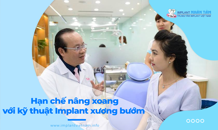 Hạn chế nâng xoang với kỹ thuật Implant xương bướm