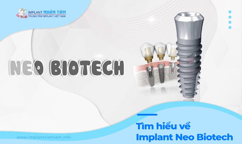 Implant Neo Biotech và những thông tin cần biết