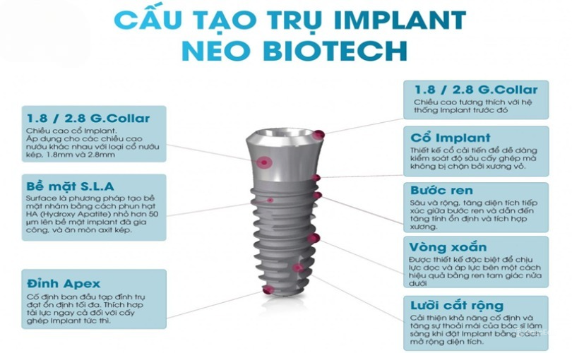 Trụ Implant Neo Biotech với thiết kế thông minh mang đến nhiều ưu điểm vượt trội